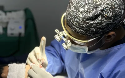 The Ultimate Guide to FUE Hair Transplant in Hyderabad: Techniques, Results, and Why Dr. Anirudh is the Best Choice