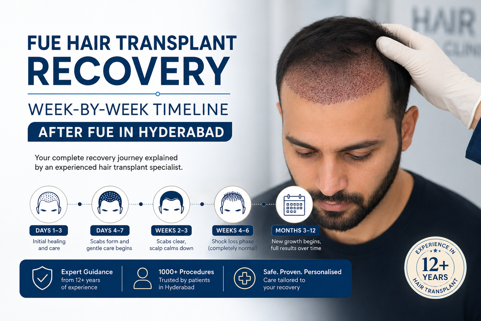 Hair Transplant Recovery Hair Transplant Recovery